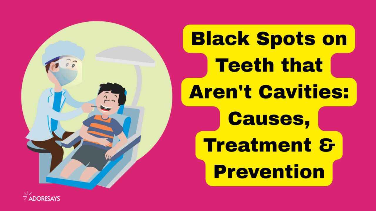 Black Spots on Teeth that Aren’t Cavities: Causes, Treatment & Prevention